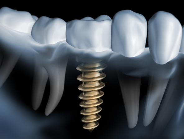 Bildschirmfoto 2025 08 13 um 14.36.58